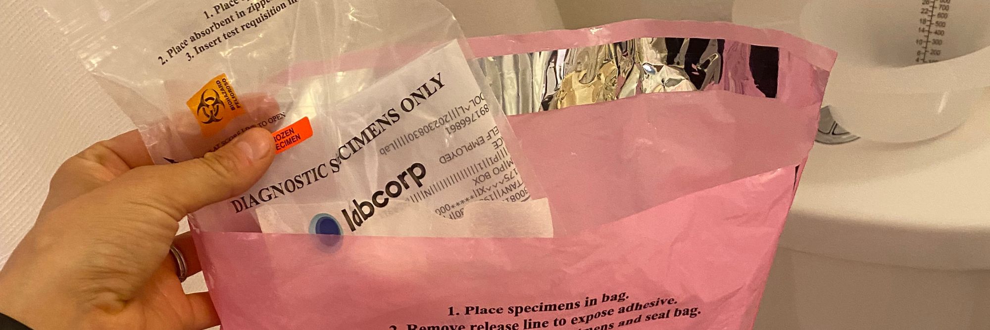 How to do a stool test 10 simple steps